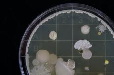 Fungo della muffa con spore (al microscopio)